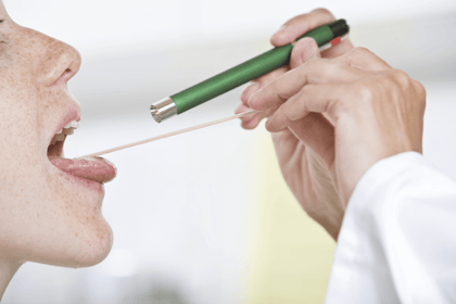 Strep Throat Pictures